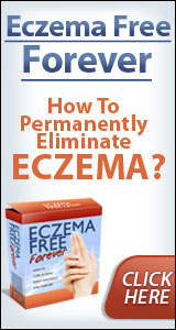 Eczema Free Forever - E-book Review